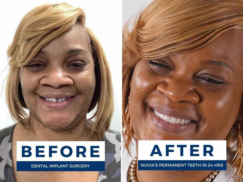 24 Hour Dental Implants Orlando FL | Nuvia Dental Implant Center
